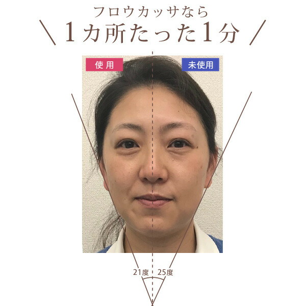 楽天市場】EMS 進化系かっさ 美顔器 フロウカッサ FLOW KASSA かっさ