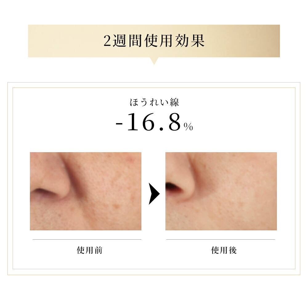 楽天市場】【期間限定 4,500円OFF☆5,480円】美顔器 EMS 顔 美顔器