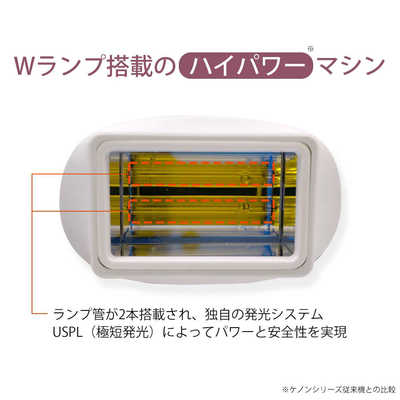 エムテック 家庭用脱毛器 KE-NON(ケノン) パールホワイト [フラッシュ