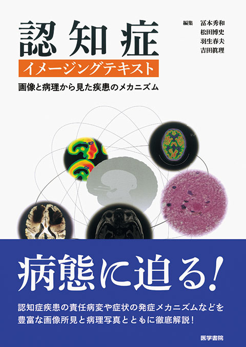 認知症イメージングテキスト | 書籍詳細 | 書籍 | 医学書院