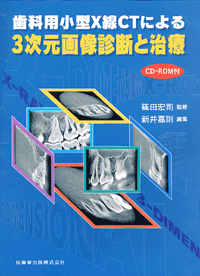歯科用小型X線CTによる3次元画像診断と治療 CD－ROM付／医歯薬出版株式会社