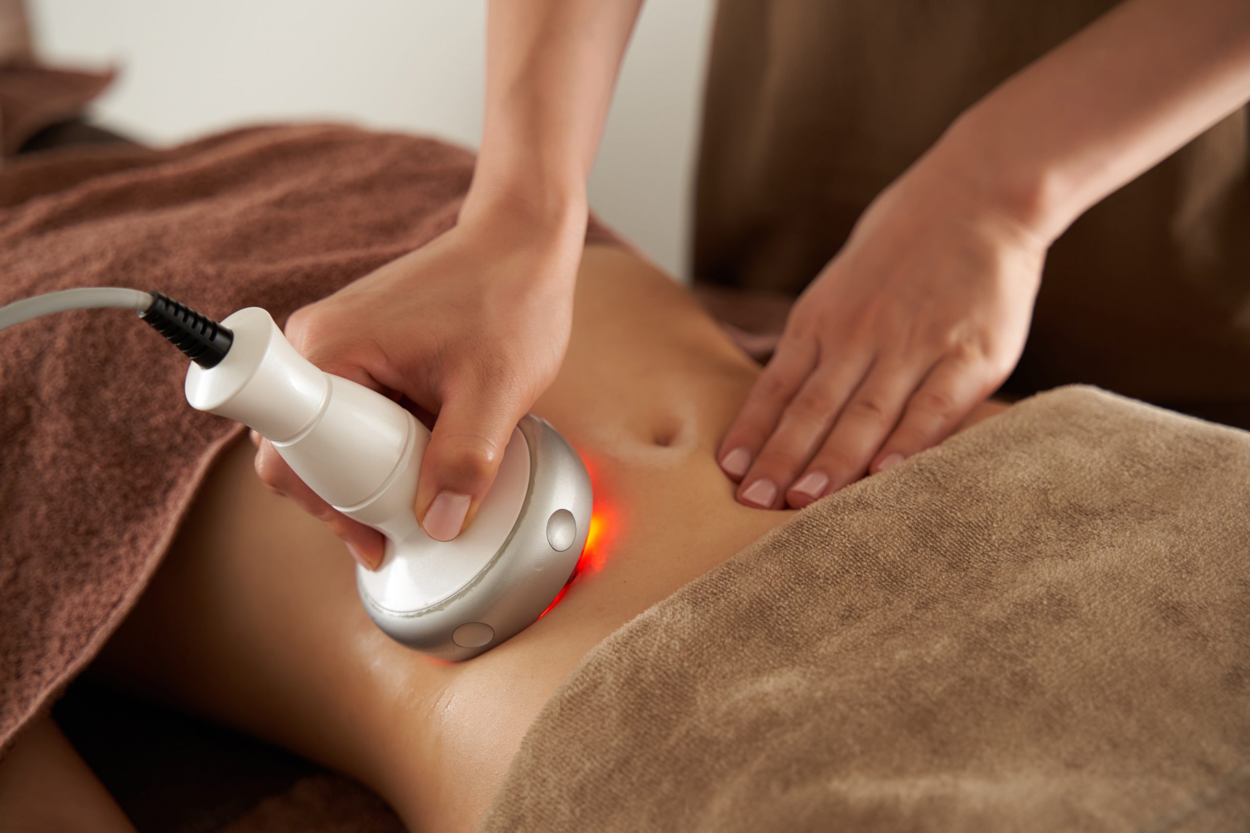 脂肪吸引のダウンタイムを短くする？イントラシュアの効果や施術方法