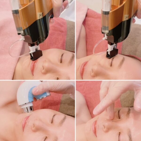 ACトリートメント - エステティックサロンSARA | 山口県宇部市