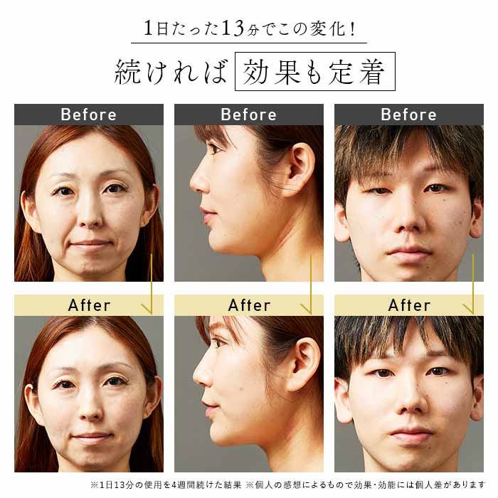 STELLA BEAUTE BEAUTY FACE STICK(美顔器)