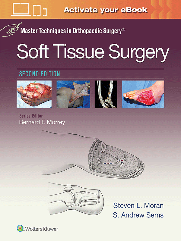 Master Techniques in Orthopaedic Surgery: Soft Tissue Surgery, 2nd
