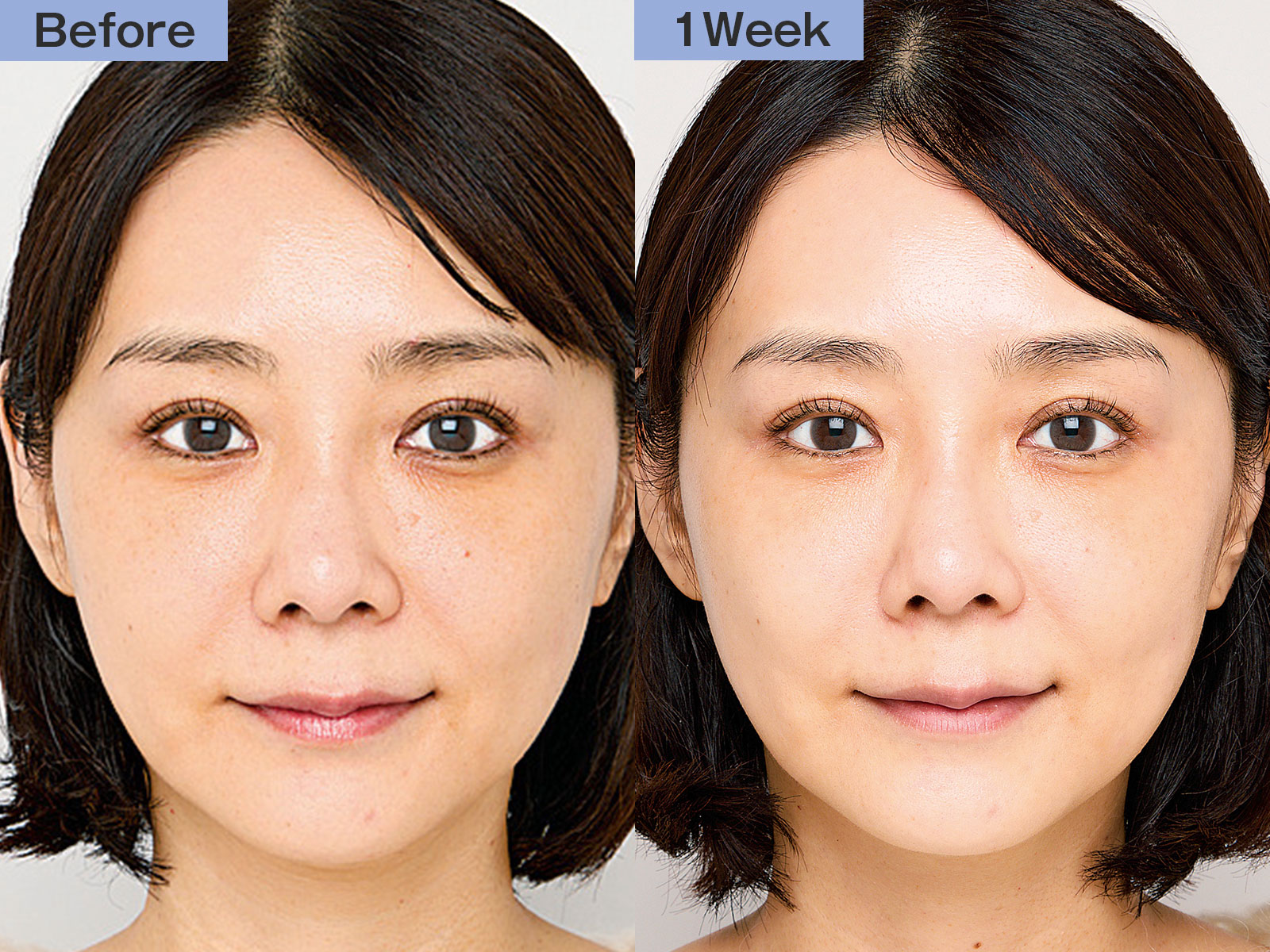 2026年最新版！シミ・シワ・老化を止める「最強美白」決定版 | 美ST ONLINE