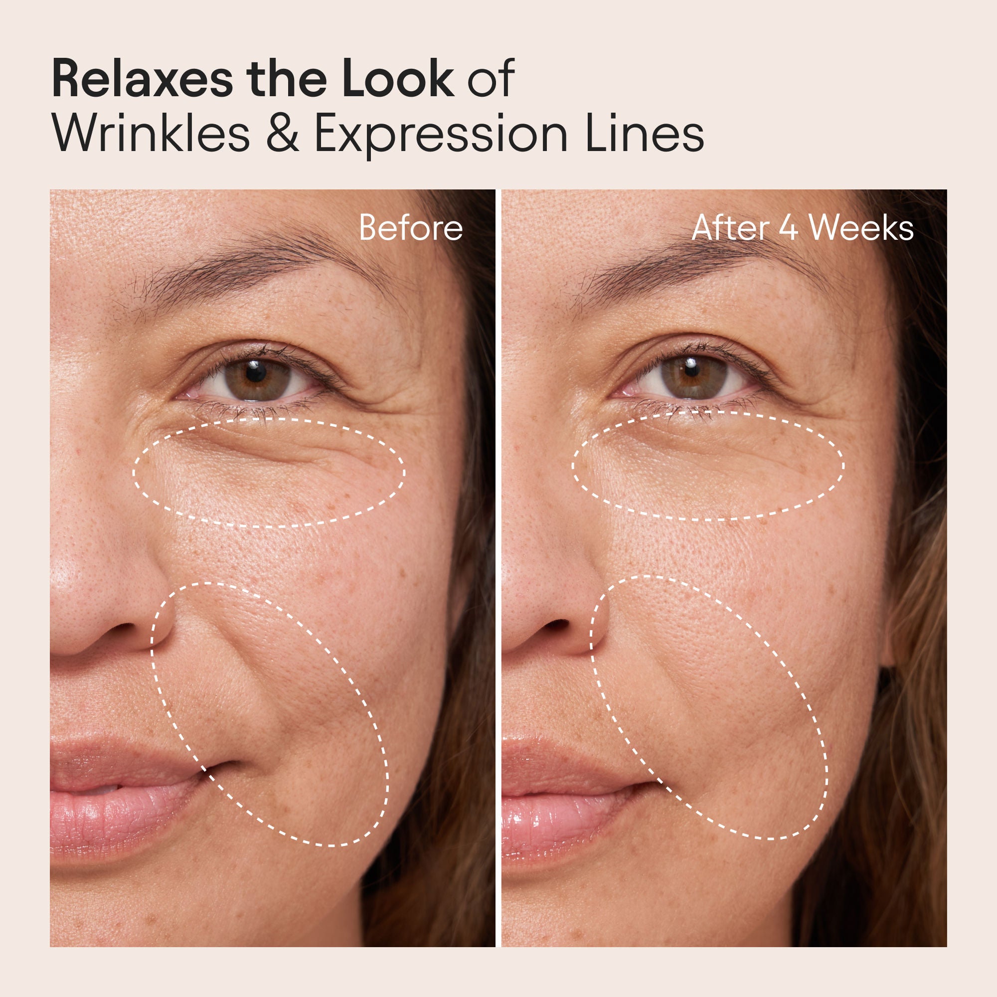 Alpyn Beauty Barrier Repair Cream Moisturizer for Eczema, Wrinkle