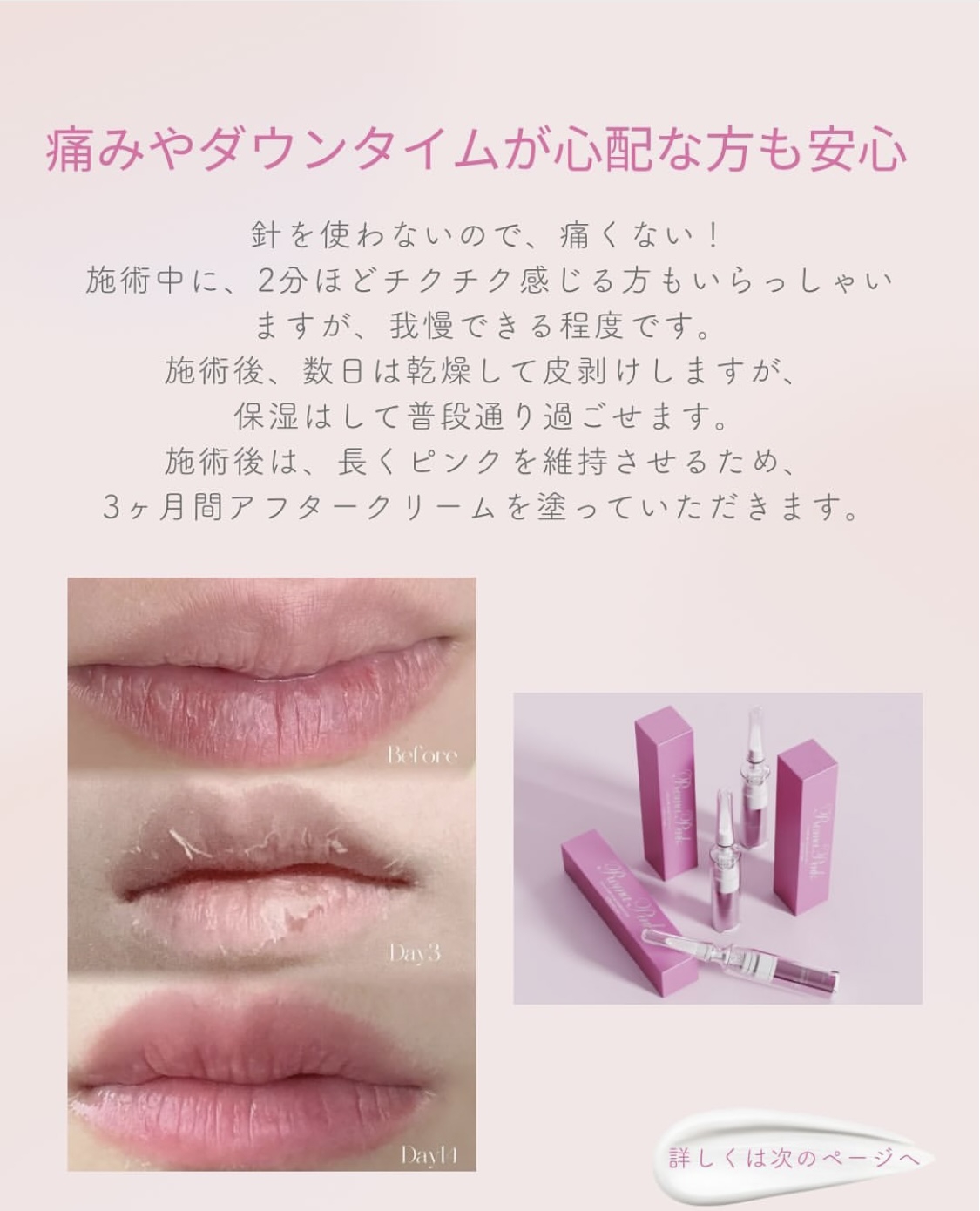 ローマピンクとは？ | Mahana