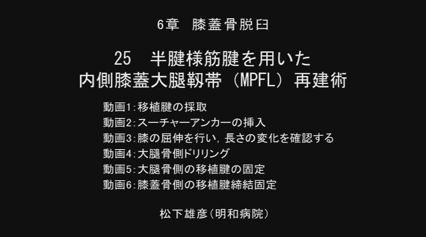 整形外科SURGICAL TECHNIQUE BOOKS 14 膝の外傷 診断・適応・手術