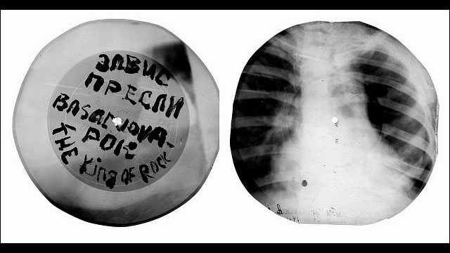 1950年代のソ連で廃棄レントゲン写真を加工して密かに作られていた