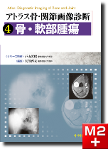 m3電子書籍 | アトラス骨・関節画像診断 4.骨・軟部腫瘍