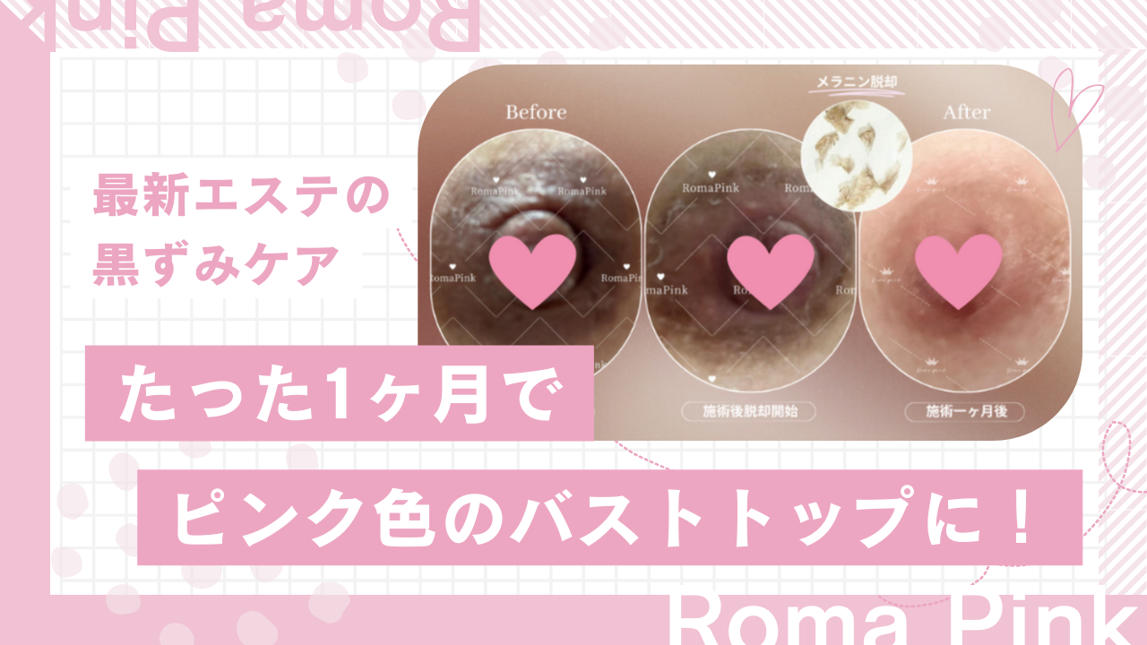 Roma Pink ローマピンク 乳首 アフタークリーム Roma Pink アフター