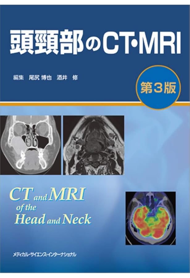 胸部のCT 第4版 | 村田喜代史, 上甲 剛, 村山貞之, 酒井文和 |本