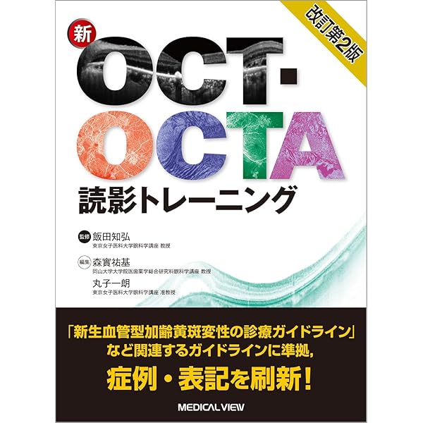Amazon.co.jp: OCTアトラス 第2版 : 吉村 長久, 板谷 正紀, 辻川 明孝: 本