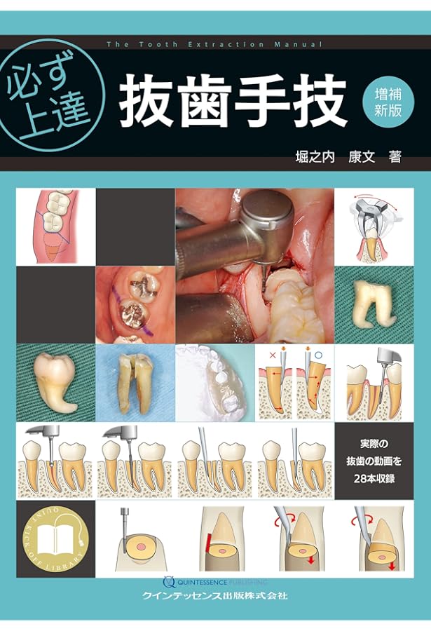 必ず上達 支台歯形成 (必ず上達シリーズ) | 岩田 健男 |本 | 通販 | Amazon