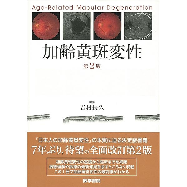 加齢黄斑変性 診療20のコツ | 柳 靖雄 |本 | 通販 | Amazon