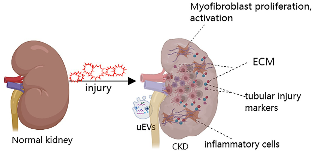 Frontiers | Advancements in the non-invasive diagnosis of renal