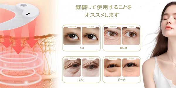 目元ケア EMS 美顔器 目元マッサージャー ems アイマッサージャー 目元