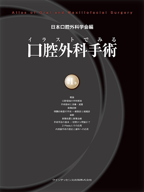 イラストでみる口腔外科手術 第2巻 - クインテッセンス出版