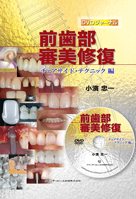 筒井昌秀臨床DVD3 インプラント周囲軟組織のマネジメント