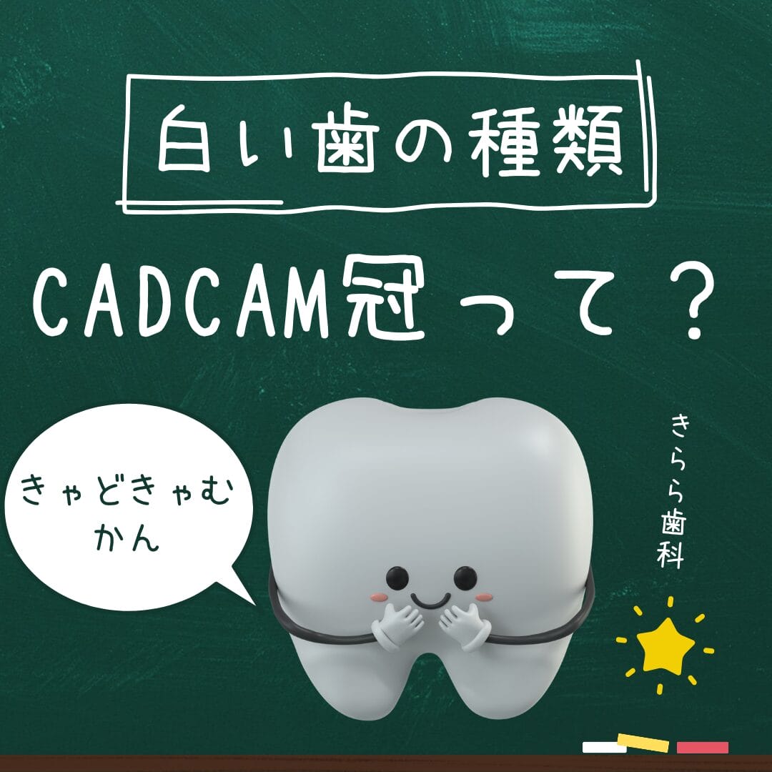 CADCAM冠について | きらら歯科【秋川駅・年中無休・朝7時～夜21時】