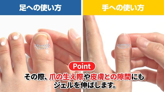 Amazon.co.jp: 北の快適工房『ヒアロエイド』セット 薬用 爪周りジェル