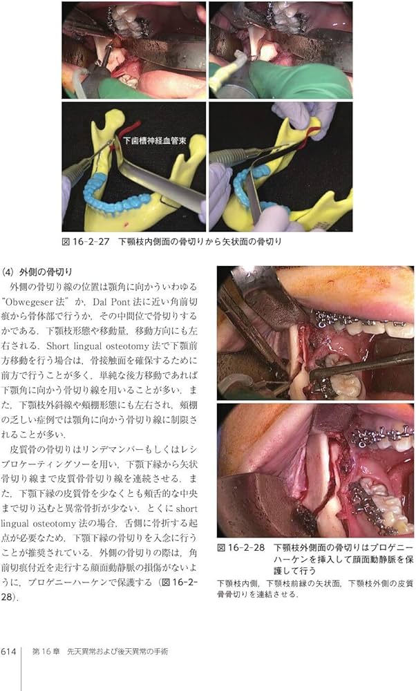口腔外科学 第4版 | 白砂 兼光, 古郷 幹彦 |本 | 通販 | Amazon
