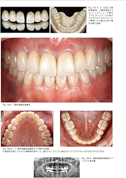 包括的治療戦略 Vol.2 for Functional Management | 土屋 賢司 |本