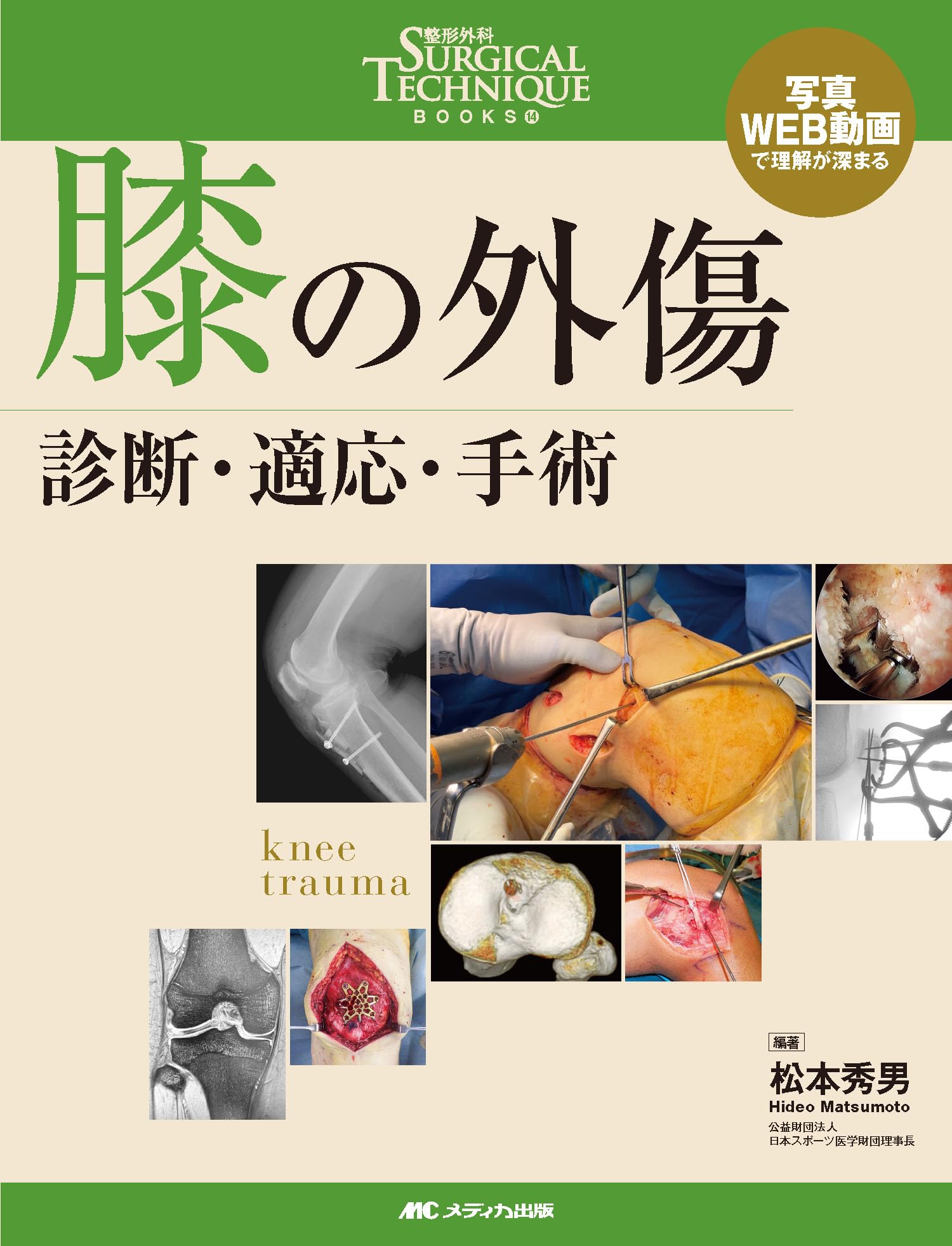 膝の外傷：診断・適応・手術 (整形外科SURGICAL TECHNIQUE BOOKS 14