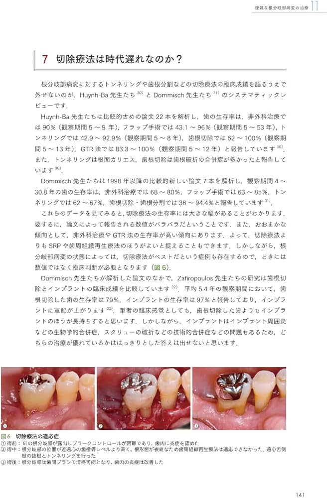 エビデンス×臨床判断から導く実践的歯周治療 | 星 嵩 |本 | 通販 | Amazon