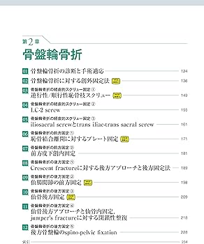骨盤骨折: 寛骨臼骨折・骨盤輪骨折の手術手技 (整形外科SURGICAL