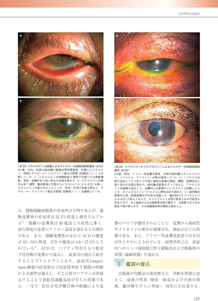 眼科診療ガイド 第2版 裁断済み 眼科診療ガイド 第2版 | 根木 昭 |本