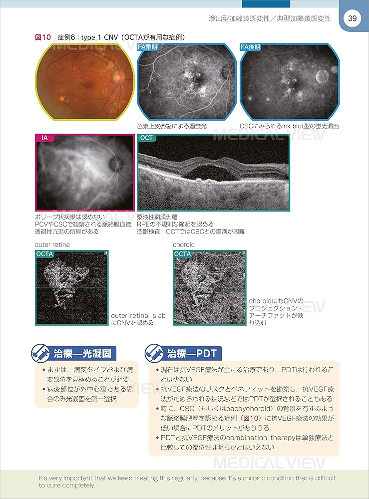網膜診療クローズアップ 改訂第2版 | 柳 靖雄 |本 | 通販 | Amazon