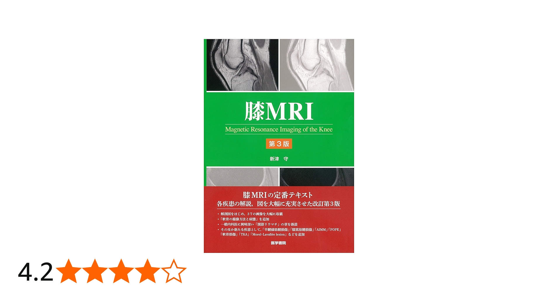 膝MRI 第3版 | 新津 守 |本 | 通販 | Amazon