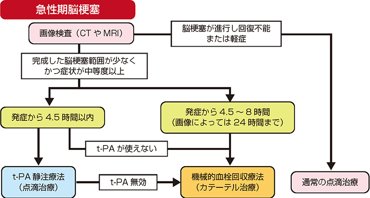 超急性期脳梗塞治療および血管内治療 脳梗塞 | 病気と治療の検索サイト