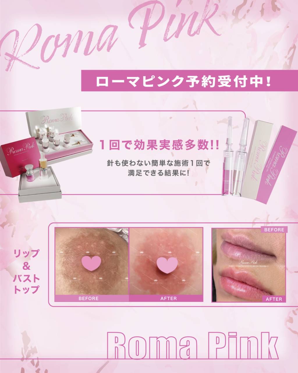 今！世界で話題の韓国美容・・・ROMA PINK(ローマピンク)予約開始