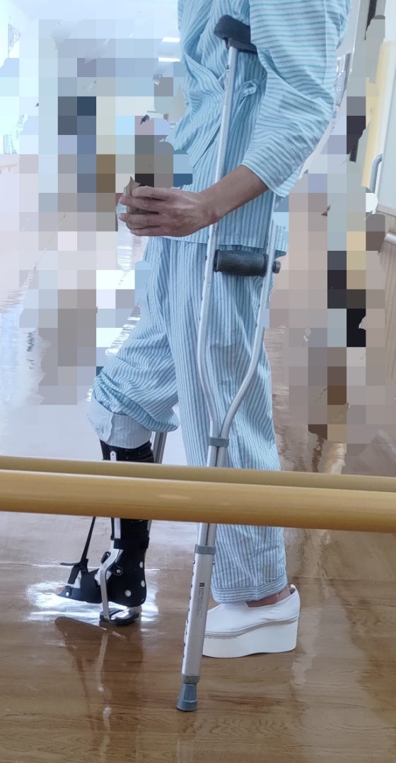 PTB装具 | 足首骨折のブログ脛骨腓骨遠位端骨折