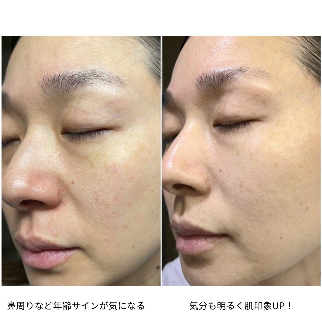 あのMONNALIから誕生】ISBEST(イズベスト)の活性クリームのお取扱が