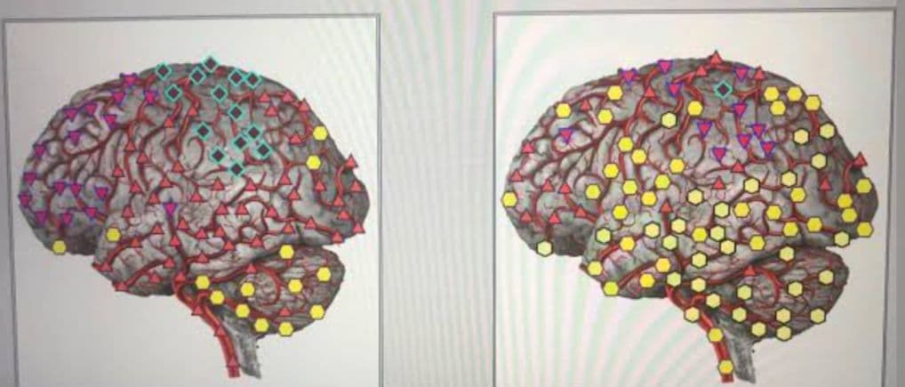 期間限定セール☆波動測定器18D NLS メタトロン ニュースキャン